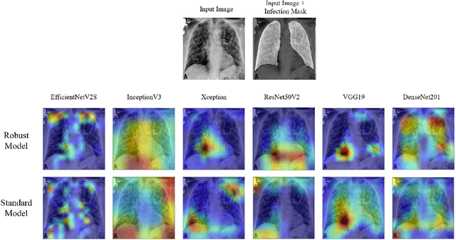 Figure 4 for Robust and Interpretable COVID-19 Diagnosis on Chest X-ray Images using Adversarial Training