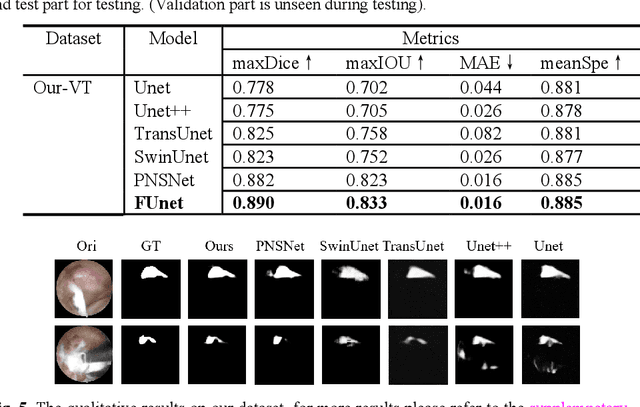 Figure 2 for Spinal nerve segmentation method and dataset construction in endoscopic surgical scenarios