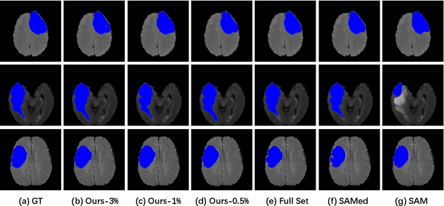 Figure 4 for Cheap Lunch for Medical Image Segmentation by Fine-tuning SAM on Few Exemplars