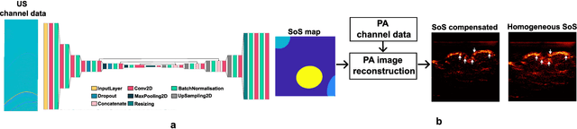 Figure 1 for Learning-based sound speed reconstruction and aberration correction in linear-array photoacoustic/ultrasound imaging