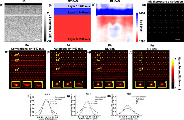 Figure 2 for Learning-based sound speed reconstruction and aberration correction in linear-array photoacoustic/ultrasound imaging