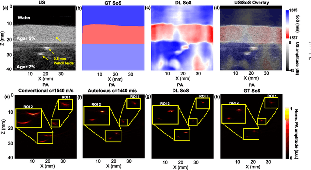 Figure 3 for Learning-based sound speed reconstruction and aberration correction in linear-array photoacoustic/ultrasound imaging