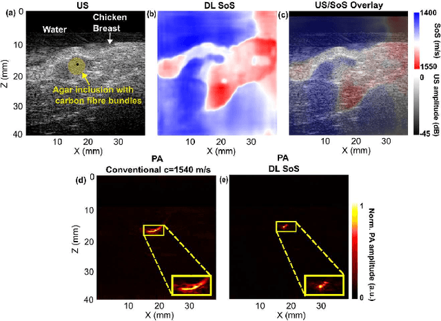Figure 4 for Learning-based sound speed reconstruction and aberration correction in linear-array photoacoustic/ultrasound imaging