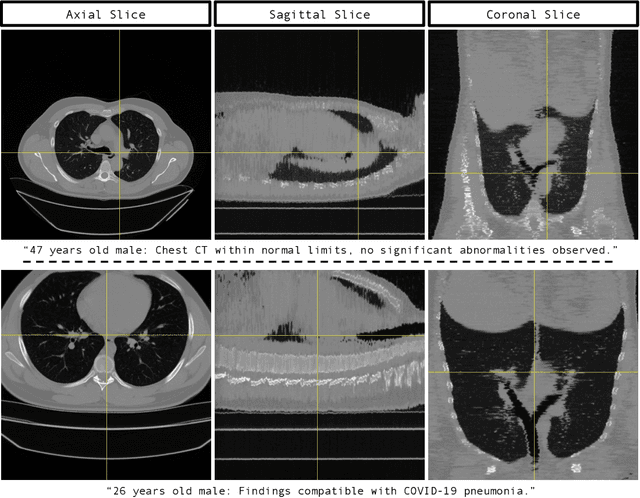 Figure 2 for GenerateCT: Text-Guided 3D Chest CT Generation