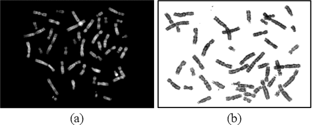 Figure 1 for Masked conditional variational autoencoders for chromosome straightening
