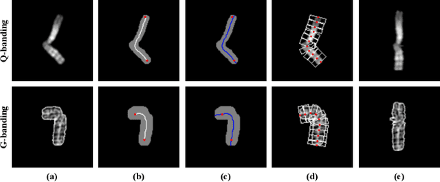 Figure 2 for Masked conditional variational autoencoders for chromosome straightening