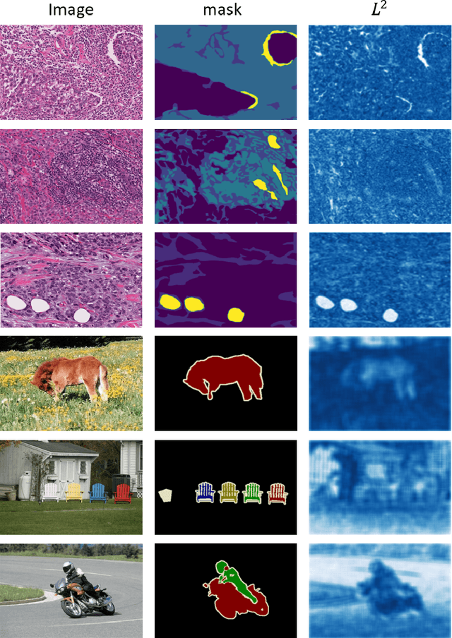 Figure 1 for Consistency Regularisation in Varying Contexts and Feature Perturbations for Semi-Supervised Semantic Segmentation of Histology Images