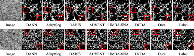 Figure 4 for Unsupervised Domain Adaptation for Neuron Membrane Segmentation based on Structural Features