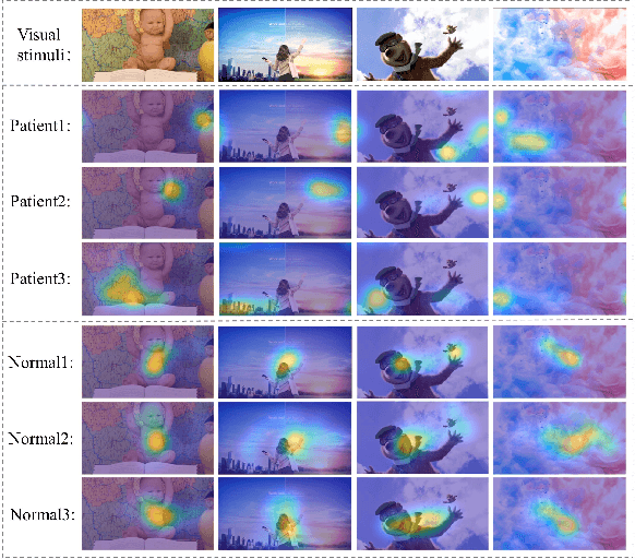 Figure 4 for Deep Learning-based Eye-Tracking Analysis for Diagnosis of Alzheimer's Disease Using 3D Comprehensive Visual Stimuli