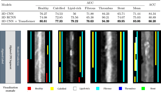 Figure 4 for O2CTA: Introducing Annotations from OCT to CCTA in Coronary Plaque Analysis