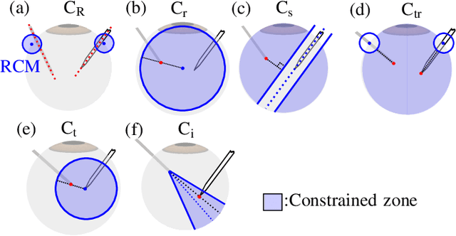 Figure 2 for Vitreoretinal Surgical Robotic System with Autonomous Orbital Manipulation using Vector-Field Inequalities