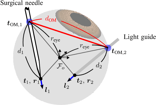 Figure 3 for Vitreoretinal Surgical Robotic System with Autonomous Orbital Manipulation using Vector-Field Inequalities