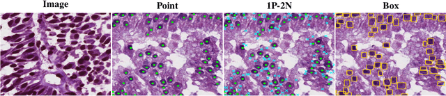 Figure 1 for Guided Prompting in SAM for Weakly Supervised Cell Segmentation in Histopathological Images