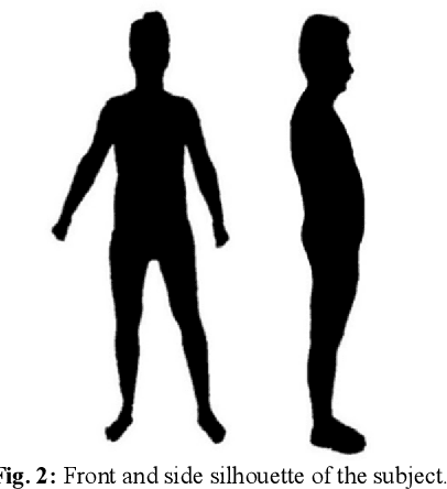 Figure 2 for Adjustable Method Based on Body Parts for Improving the Accuracy of 3D Reconstruction in Visually Important Body Parts from Silhouettes