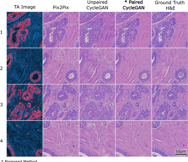 Figure 4 for Virtual Histology with Photon Absorption Remote Sensing using a Cycle-Consistent Generative Adversarial Network with Weakly Registered Pairs
