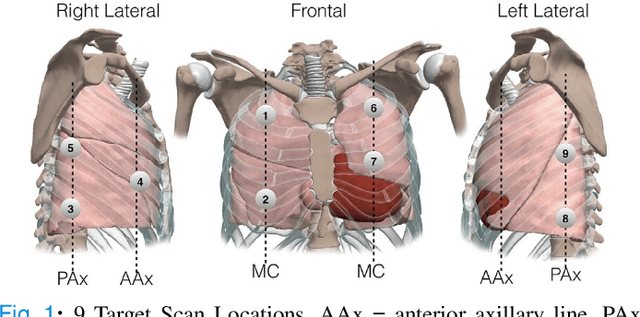 Figure 1 for Localizing Scan Targets from Human Pose for Autonomous Lung Ultrasound Imaging