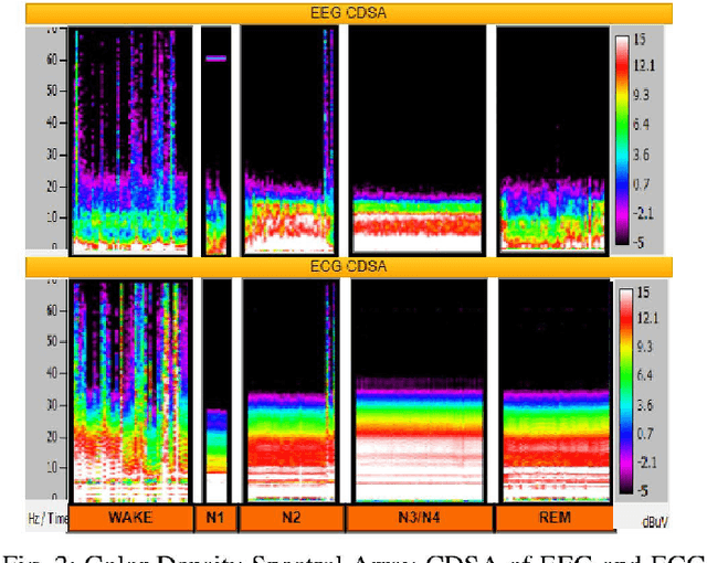 Figure 2 for EEG aided boosting of single-lead ECG based sleep staging with Deep Knowledge Distillation