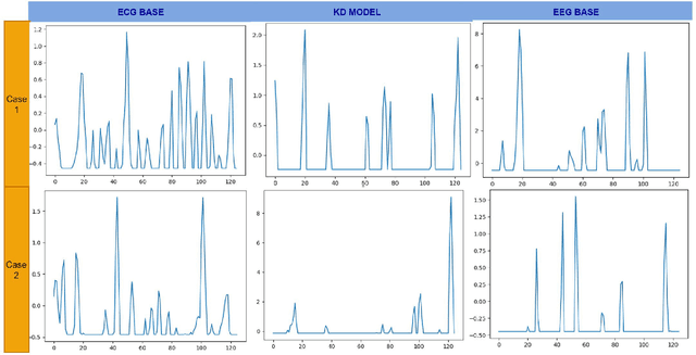 Figure 4 for EEG aided boosting of single-lead ECG based sleep staging with Deep Knowledge Distillation
