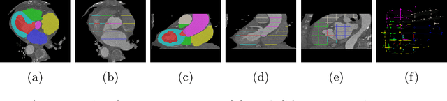 Figure 1 for 3D Medical Image Segmentation with Sparse Annotation via Cross-Teaching between 3D and 2D Networks