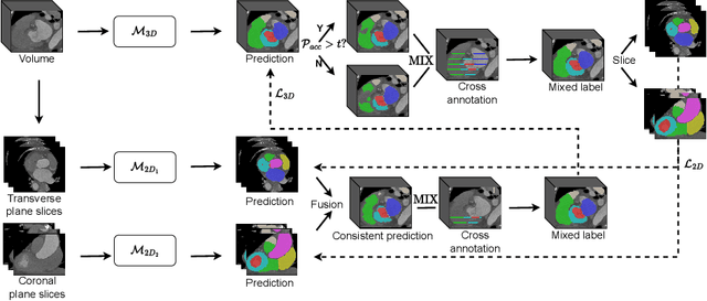 Figure 3 for 3D Medical Image Segmentation with Sparse Annotation via Cross-Teaching between 3D and 2D Networks