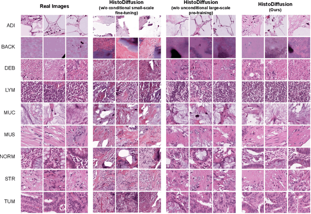 Figure 4 for Synthetic Augmentation with Large-scale Unconditional Pre-training