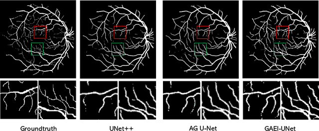 Figure 4 for GAEI-UNet: Global Attention and Elastic Interaction U-Net for Vessel Image Segmentation