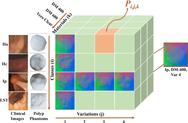 Figure 1 for Classification of Colorectal Cancer Polyps via Transfer Learning and Vision-Based Tactile Sensing