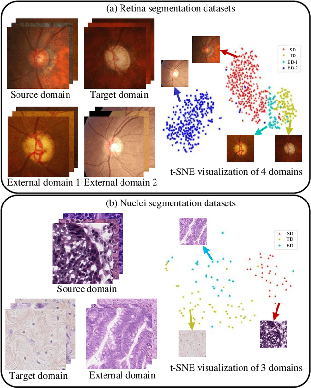 Figure 3 for Curriculum-Based Augmented Fourier Domain Adaptation for Robust Medical Image Segmentation