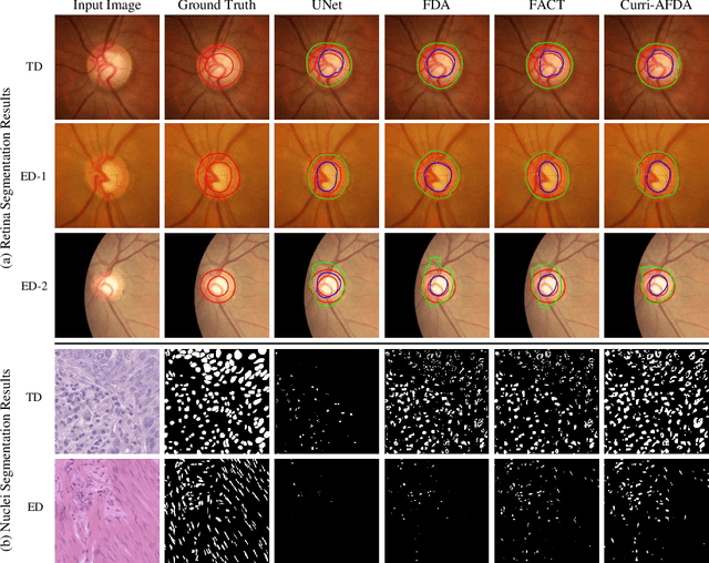 Figure 4 for Curriculum-Based Augmented Fourier Domain Adaptation for Robust Medical Image Segmentation