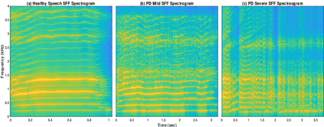 Figure 1 for Severity Classification of Parkinson's Disease from Speech using Single Frequency Filtering-based Features