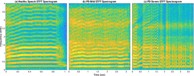 Figure 3 for Severity Classification of Parkinson's Disease from Speech using Single Frequency Filtering-based Features