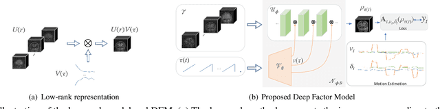 Figure 1 for Deep Factor Model: A Novel Approach for Motion Compensated Multi-Dimensional MRI