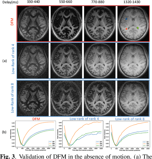 Figure 3 for Deep Factor Model: A Novel Approach for Motion Compensated Multi-Dimensional MRI