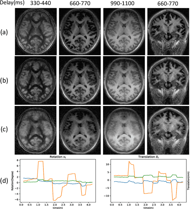 Figure 4 for Deep Factor Model: A Novel Approach for Motion Compensated Multi-Dimensional MRI