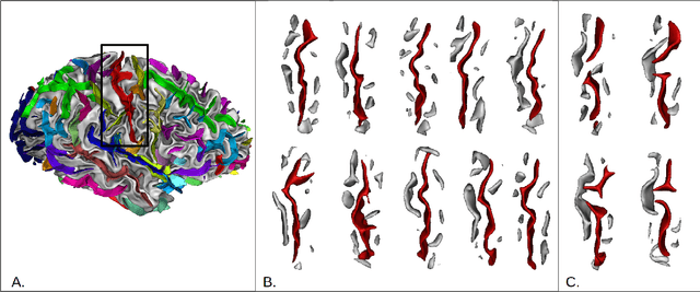 Figure 1 for Identification of Rare Cortical Folding Patterns using Unsupervised Deep Learning