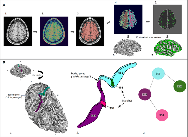 Figure 2 for Identification of Rare Cortical Folding Patterns using Unsupervised Deep Learning