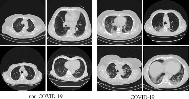 Figure 1 for Advancing COVID-19 Detection in 3D CT Scans