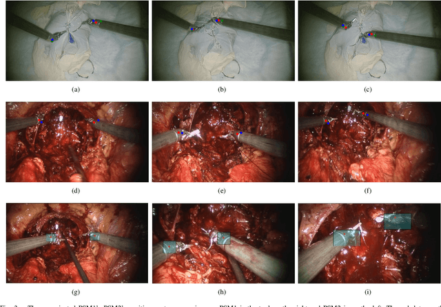 Figure 3 for Online estimation of the hand-eye transformation from surgical scenes