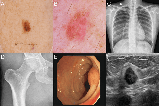 Figure 2 for Zero-shot performance of the Segment Anything Model (SAM) in 2D medical imaging: A comprehensive evaluation and practical guidelines