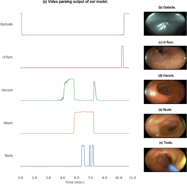 Figure 3 for Semantic Parsing of Colonoscopy Videos with Multi-Label Temporal Networks