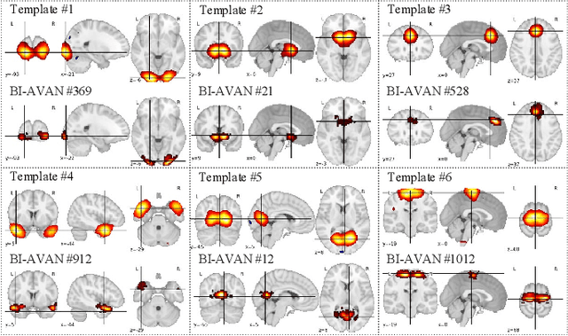 Figure 2 for BI AVAN: Brain inspired Adversarial Visual Attention Network