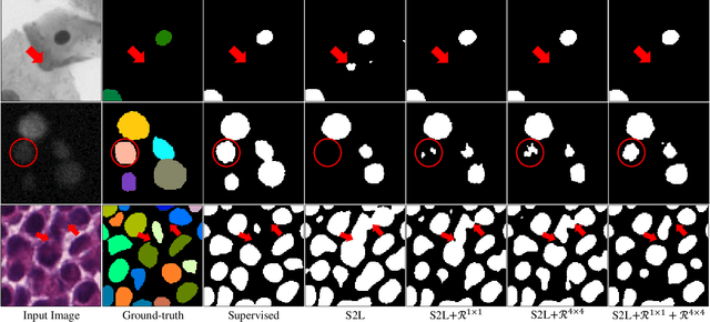 Figure 3 for Scribble-supervised Cell Segmentation Using Multiscale Contrastive Regularization