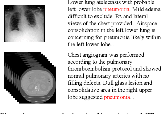 Figure 1 for Unified Medical Image Pre-training in Language-Guided Common Semantic Space