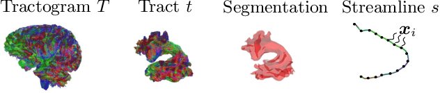 Figure 1 for atTRACTive: Semi-automatic white matter tract segmentation using active learning