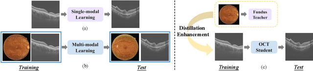 Figure 1 for Fundus-Enhanced Disease-Aware Distillation Model for Retinal Disease Classification from OCT Images