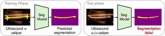 Figure 1 for Shortcut Learning in Medical Image Segmentation