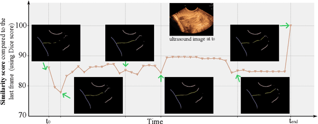 Figure 3 for Shortcut Learning in Medical Image Segmentation