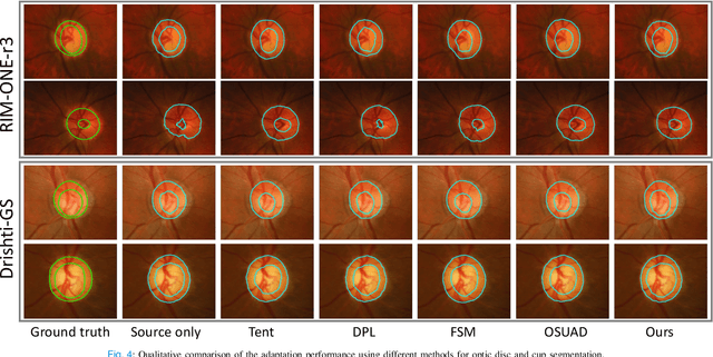 Figure 4 for A Chebyshev Confidence Guided Source-Free Domain Adaptation Framework for Medical Image Segmentation