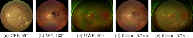 Figure 1 for Cross-domain Collaborative Learning for Recognizing Multiple Retinal Diseases from Wide-Field Fundus Images