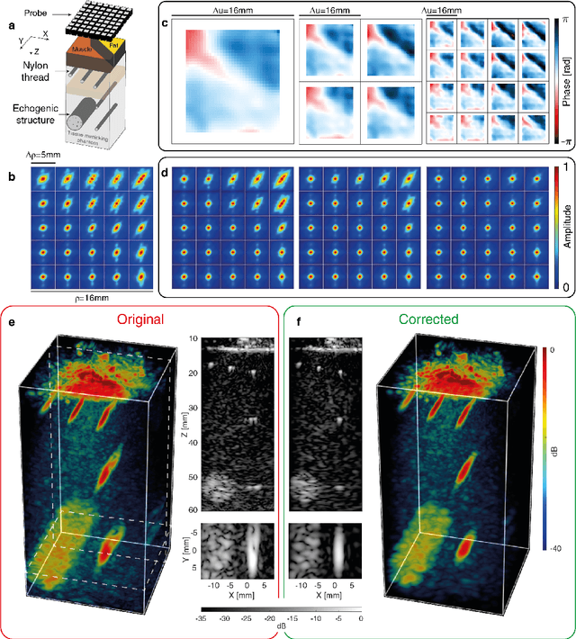 Figure 2 for Three-Dimensional Ultrasound Matrix Imaging